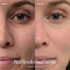 4-in-1 Red Light Therapy Wand & Activating Serum Kit - HOUSE OF SHE