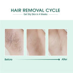 BeNat Laser IPL Hair Removal - HOUSE OF SHE