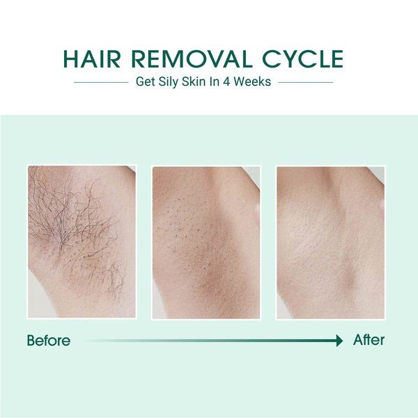 BeNat Laser IPL Hair Removal - HOUSE OF SHE